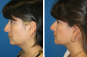 Before & After Photos